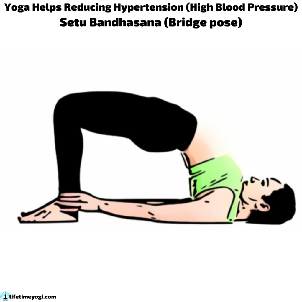 Setu Bandhasana Yoga Helps Reducing Hypertension (High Blood Pressure)
