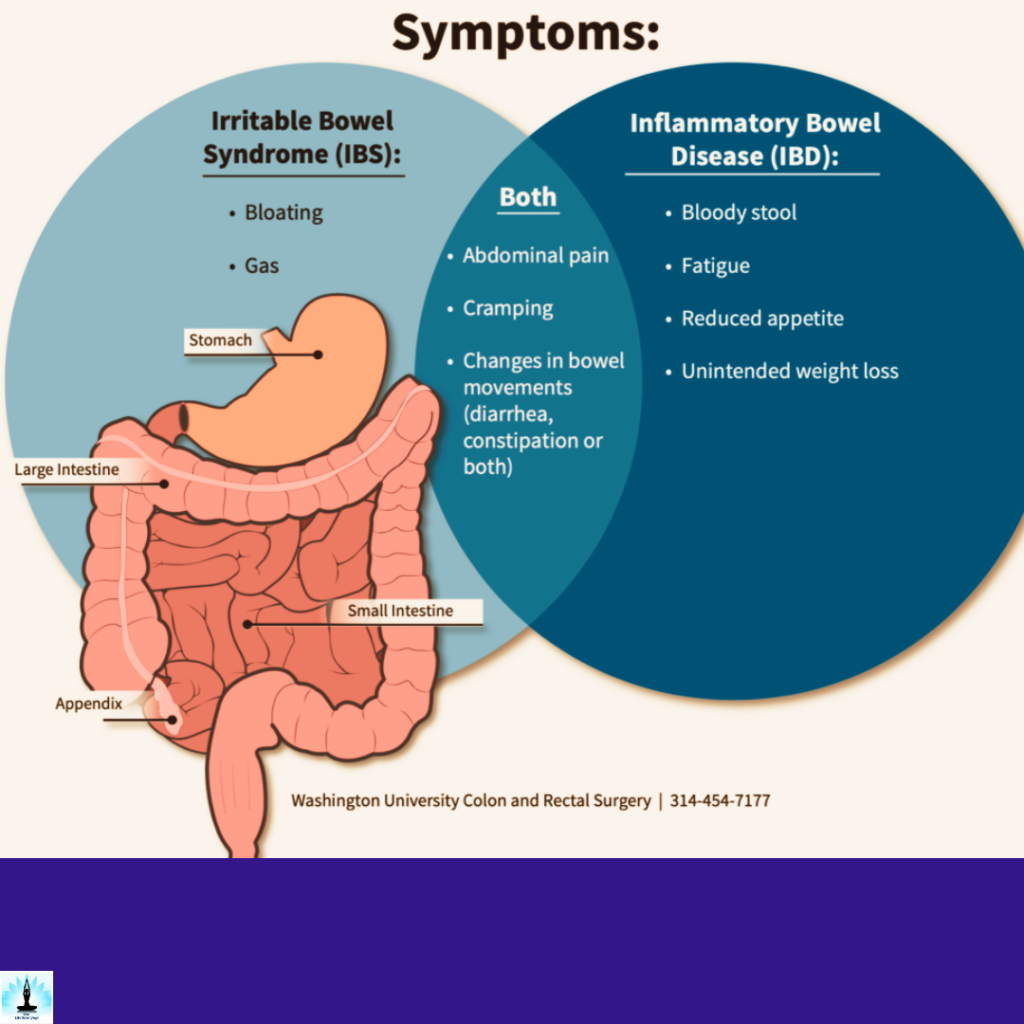 yoga techniques for managing ibd