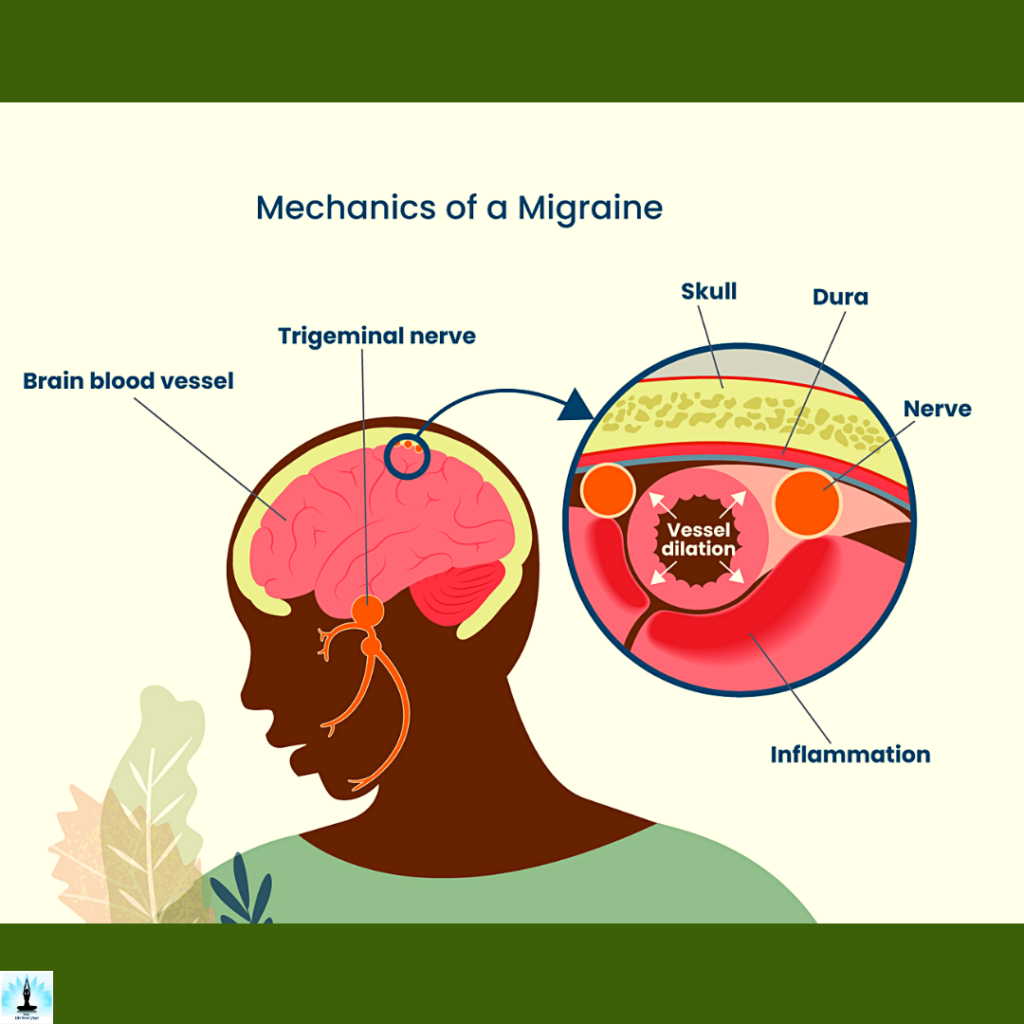 yoga for headache and migraine relief